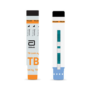 Determine TB LAM
